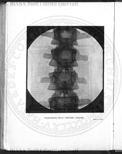 v. 1, n. 5-6 (1929-1930) - Pagina: 195